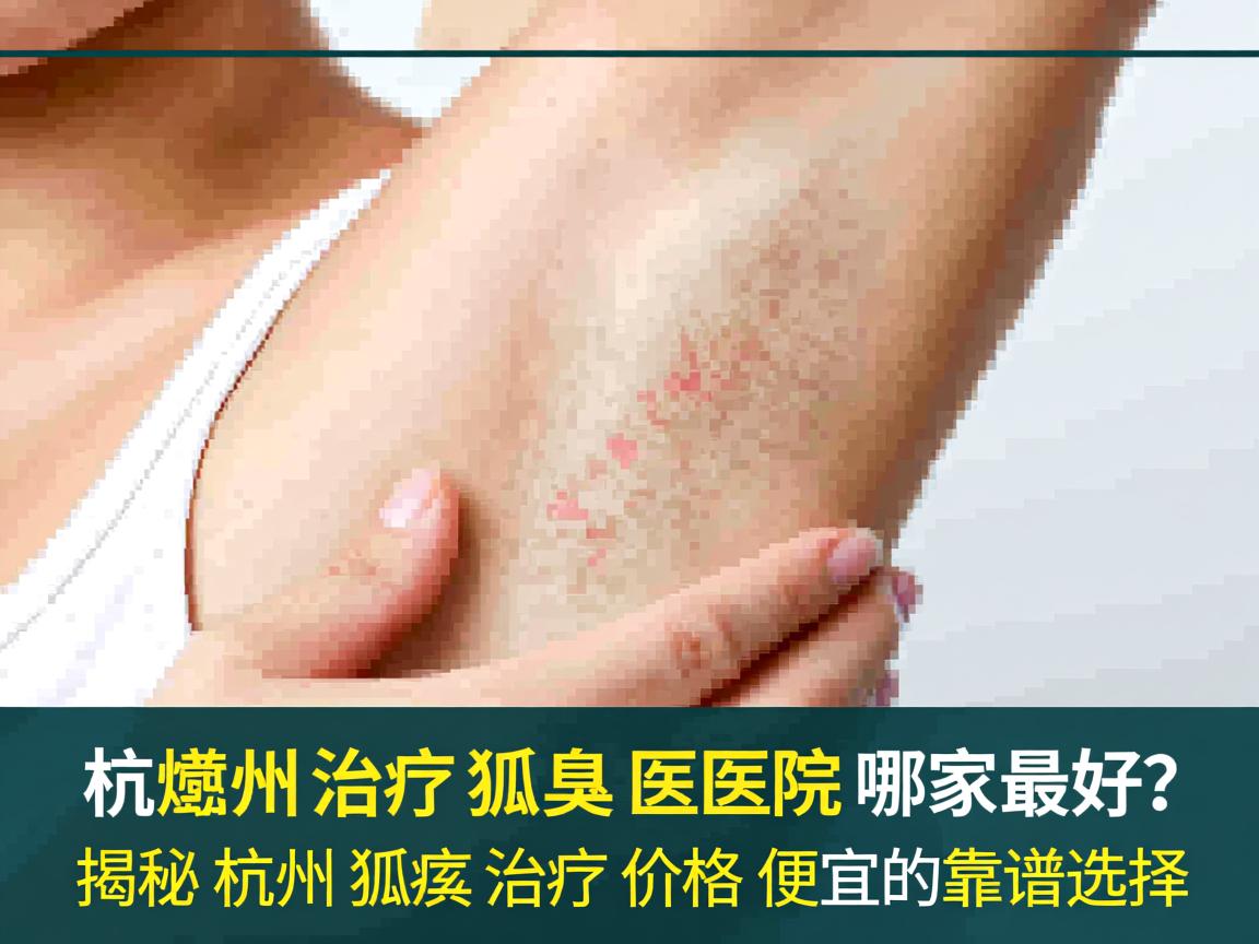 杭州治疗狐臭的医院哪家最好？揭秘杭州狐臭治疗价格便宜的靠谱选择