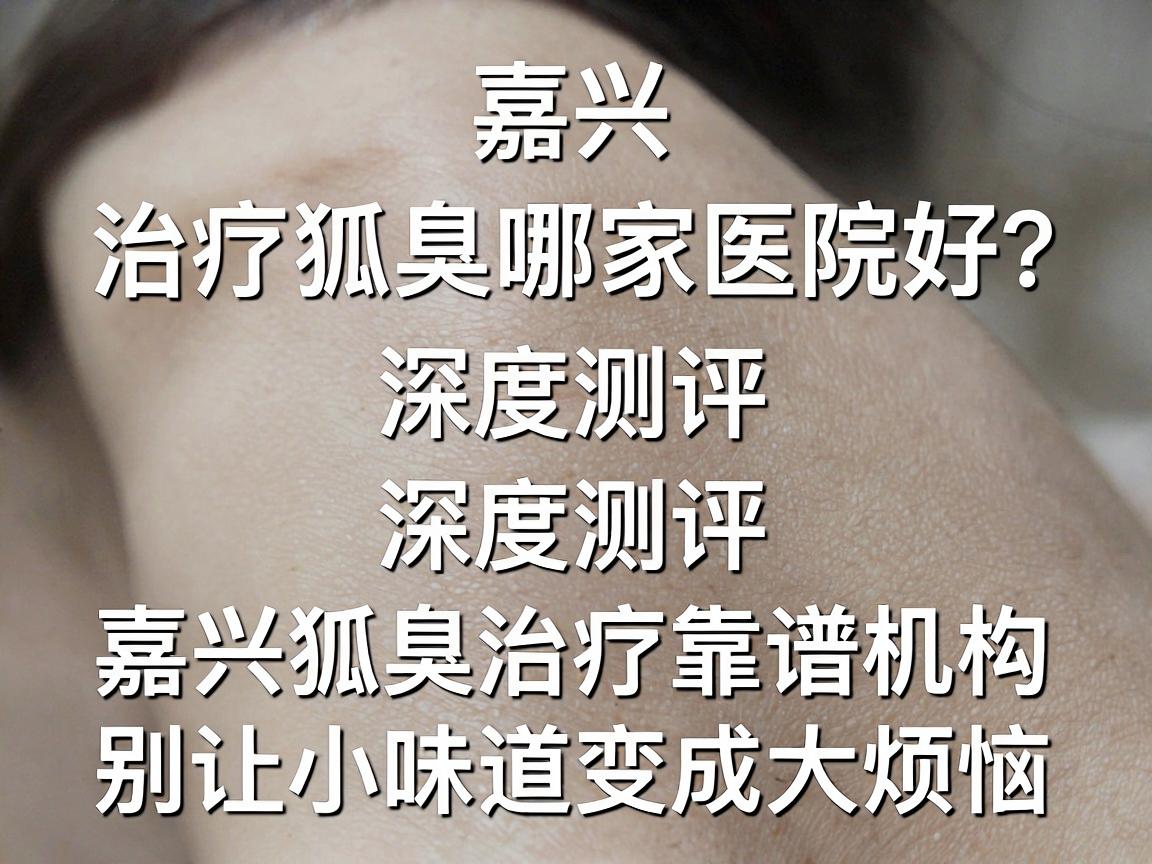 嘉兴治疗狐臭哪家医院好？深度测评嘉兴狐臭治疗靠谱机构，别让小味道变成大烦恼
