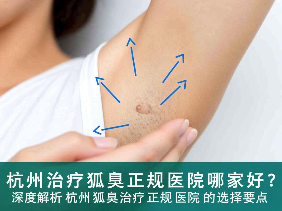 杭州治疗狐臭正规医院哪家好？深度解析杭州狐臭治疗正规医院的选择要点