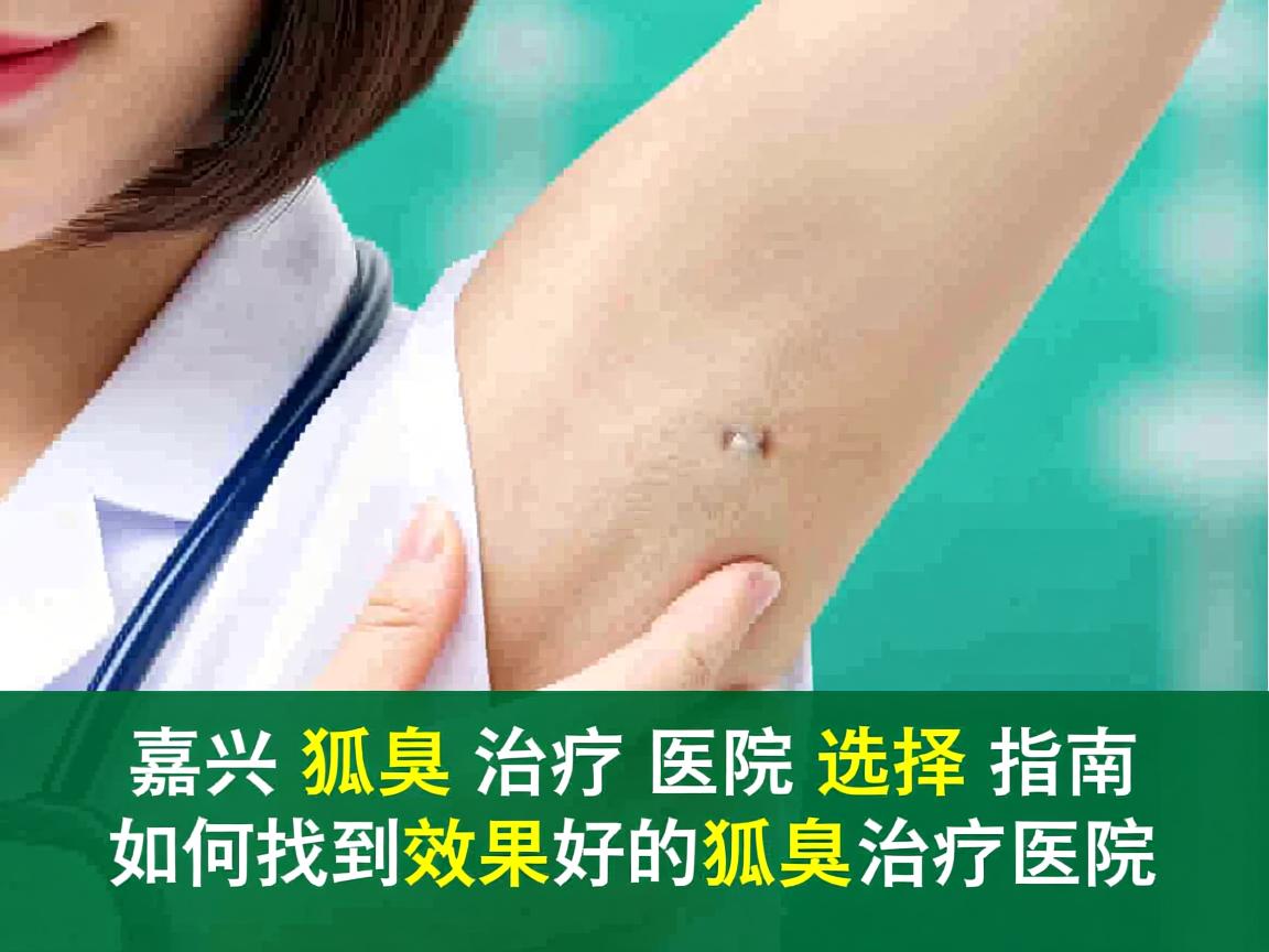 嘉兴狐臭治疗医院选择指南，如何找到效果好的狐臭治疗医院